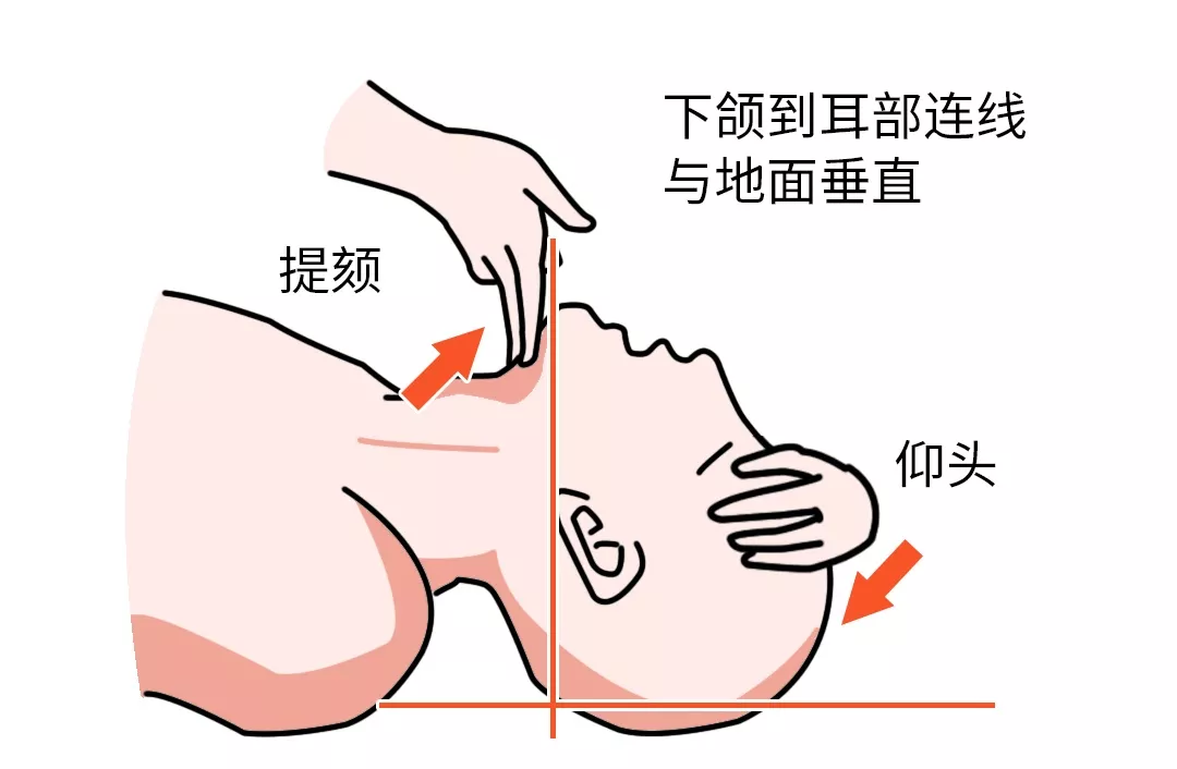 护养| 在吗?进来学心肺复苏术,关键时刻能救命