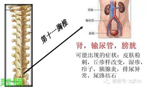 骨盆人口右倾斜经_骨盆倾斜图片(3)