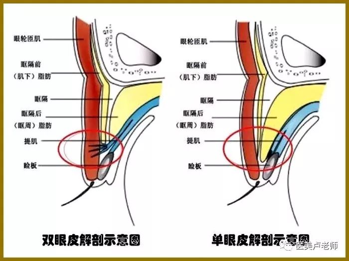 眼睑的组织结构与重睑术