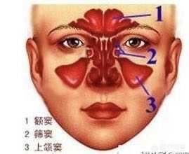 5岁宝宝鼻窦炎怎么办