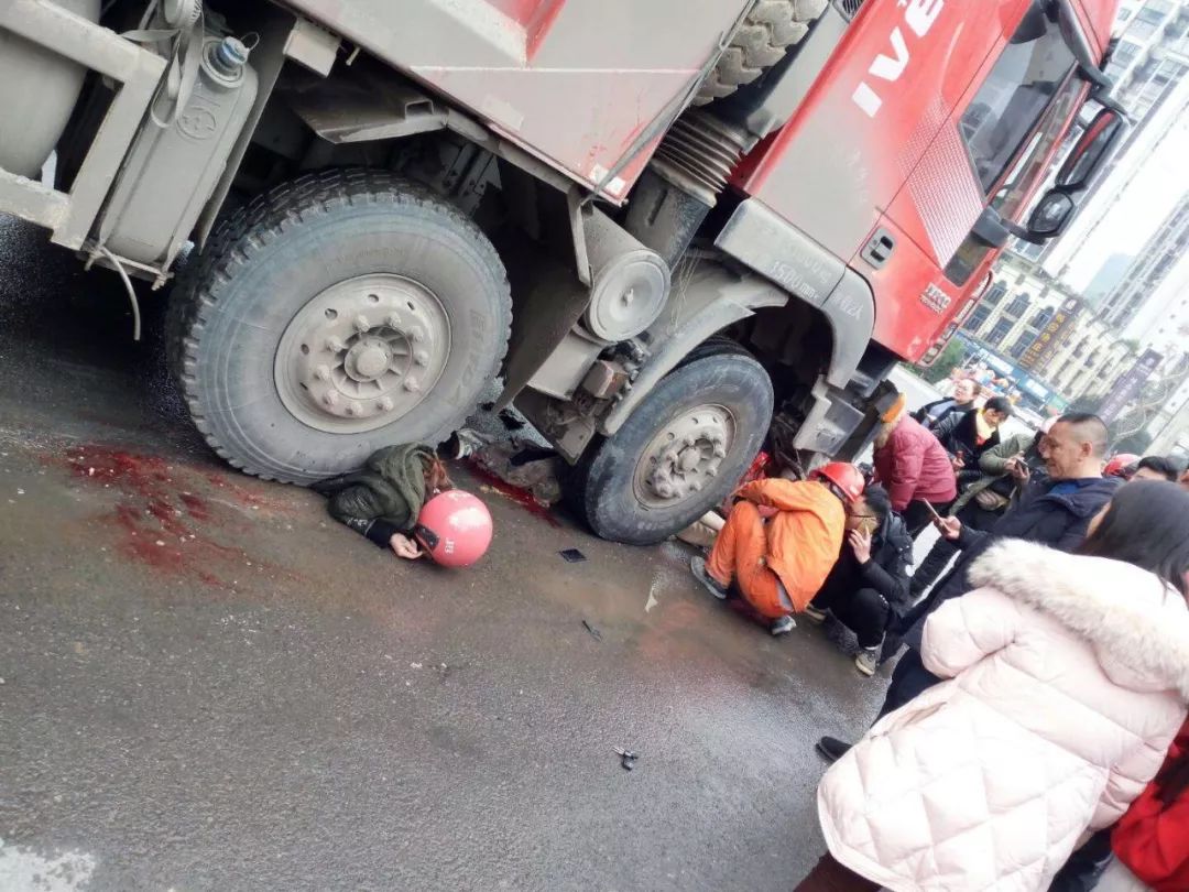 宜宾惨烈车祸后续母亲当场死亡女儿截肢