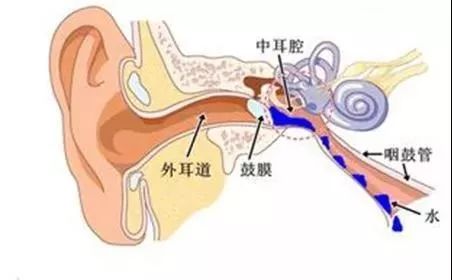 急性中耳炎及慢性中耳炎,按性质分, 分为分泌性中耳炎,化脓性中耳炎