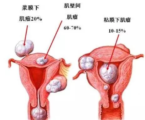 乳腺b超要脱内衣吗(2)