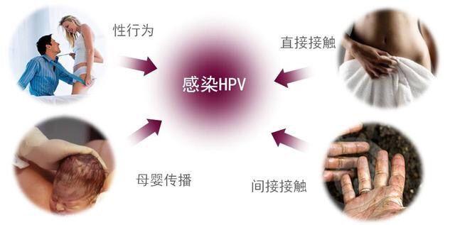 hpv症状hpv有什么样的表现