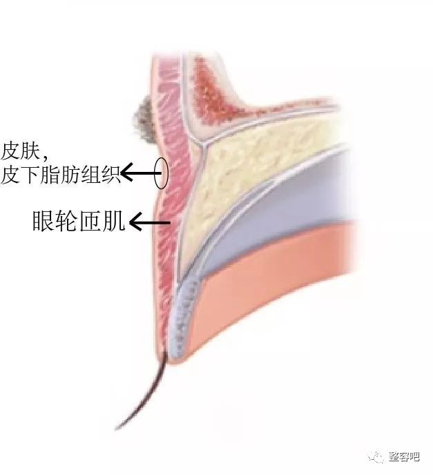 眼睑分为三层,双眼皮的形成原理:双眼皮和单眼皮结构上有根本区别我们