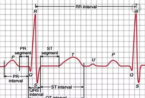 学心电图是很多医学生特别头疼的一件事.