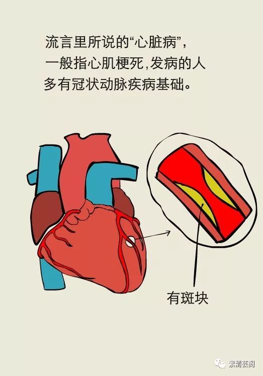 心梗发作1小时内,做这几件事不救命反而要命