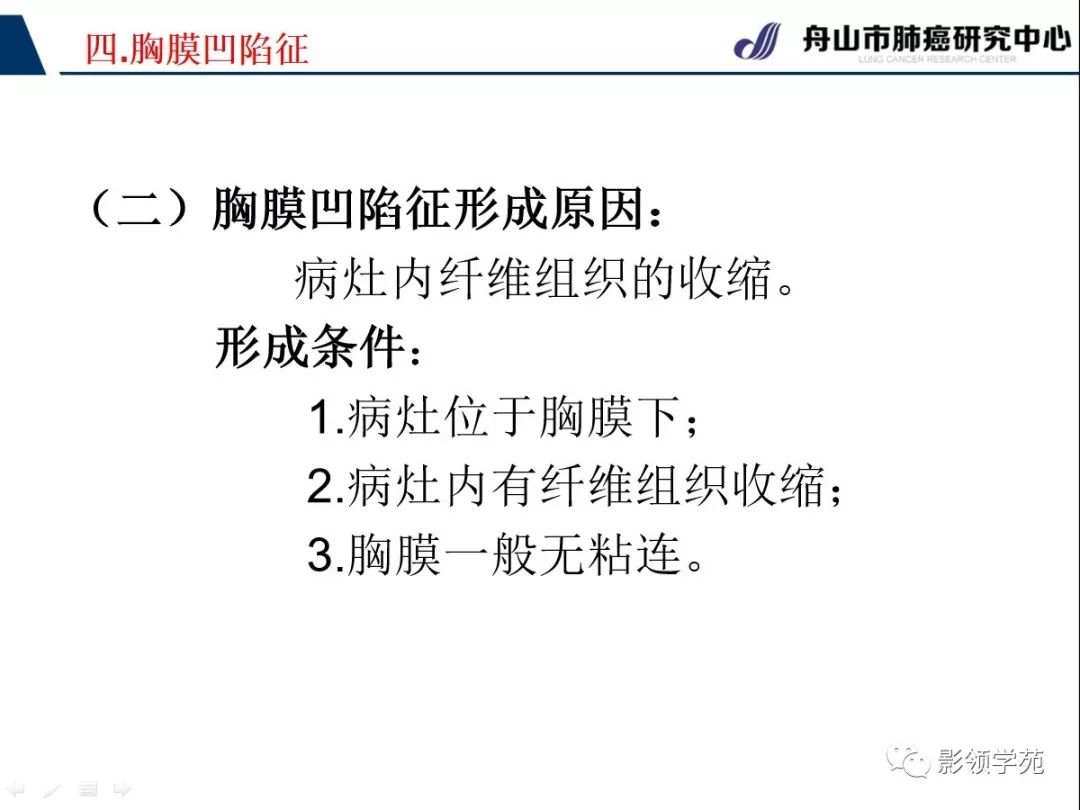 ct征象对早期肺腺癌分型之胸膜凹陷征