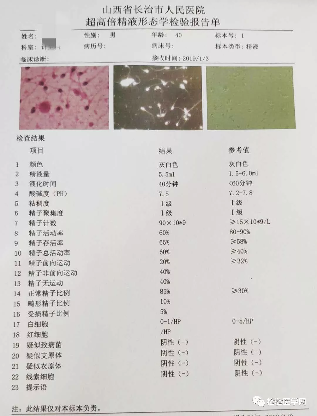 如果是做辅助生育采集精液最好在禁欲后3-5天精子活力最好的时候采集