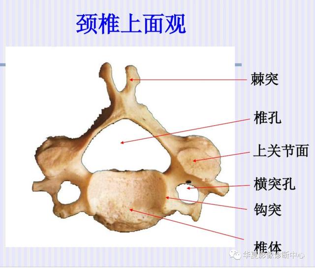 有特点记心间;《椎骨特点歌诀》两下叶支气管分出基底段时能观察中叶