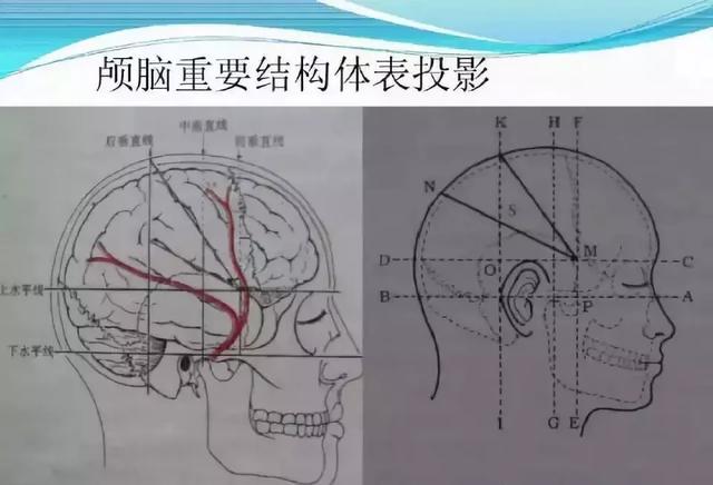 与颅内血肿,定位血肿与体表标志及颅内结构kronlein投影的网格化关系