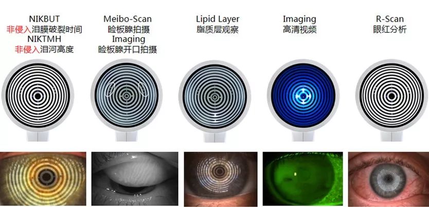 德国新一代眼表综合分析仪,落户菏泽!看有哪些先进功能?
