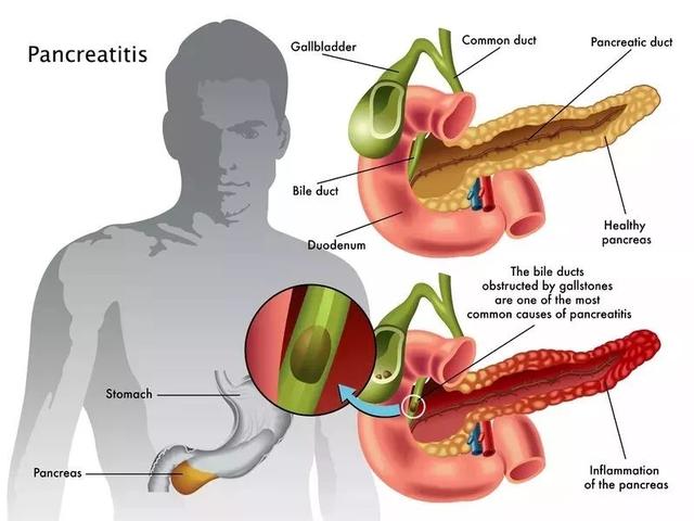 胰腺是人体的第二大消化腺