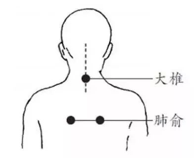 刮痧治百病,刮错最要命!