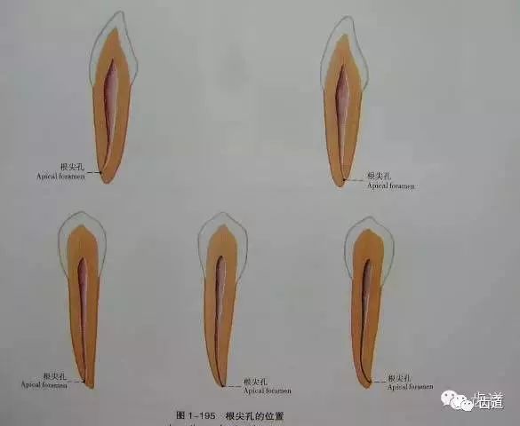 切牙的髓腔形态