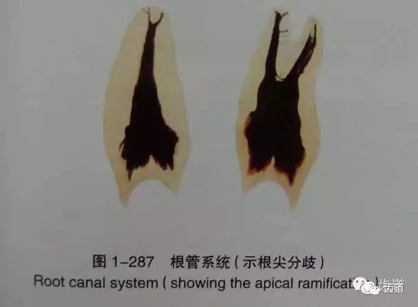 4.根尖分歧根尖1/3的根管侧支多于根中i/3,根颈1/3者最少.