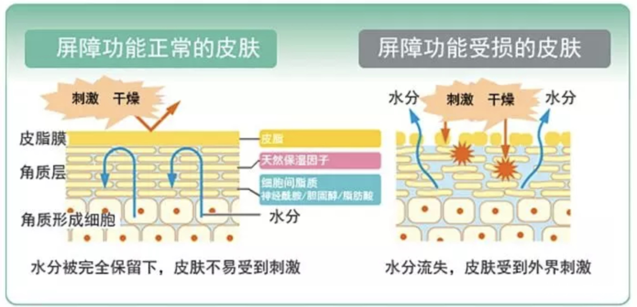 敏感肌肤分类详解_皮肤