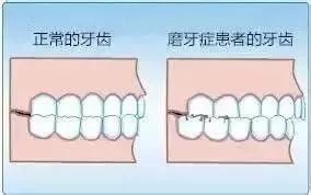                     孩子夜磨牙怎么办？我们找到了这些原因和治疗方法