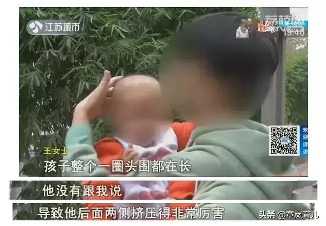                     好心为双胞胎儿子矫正头型，为何头型成了“奥特曼”？