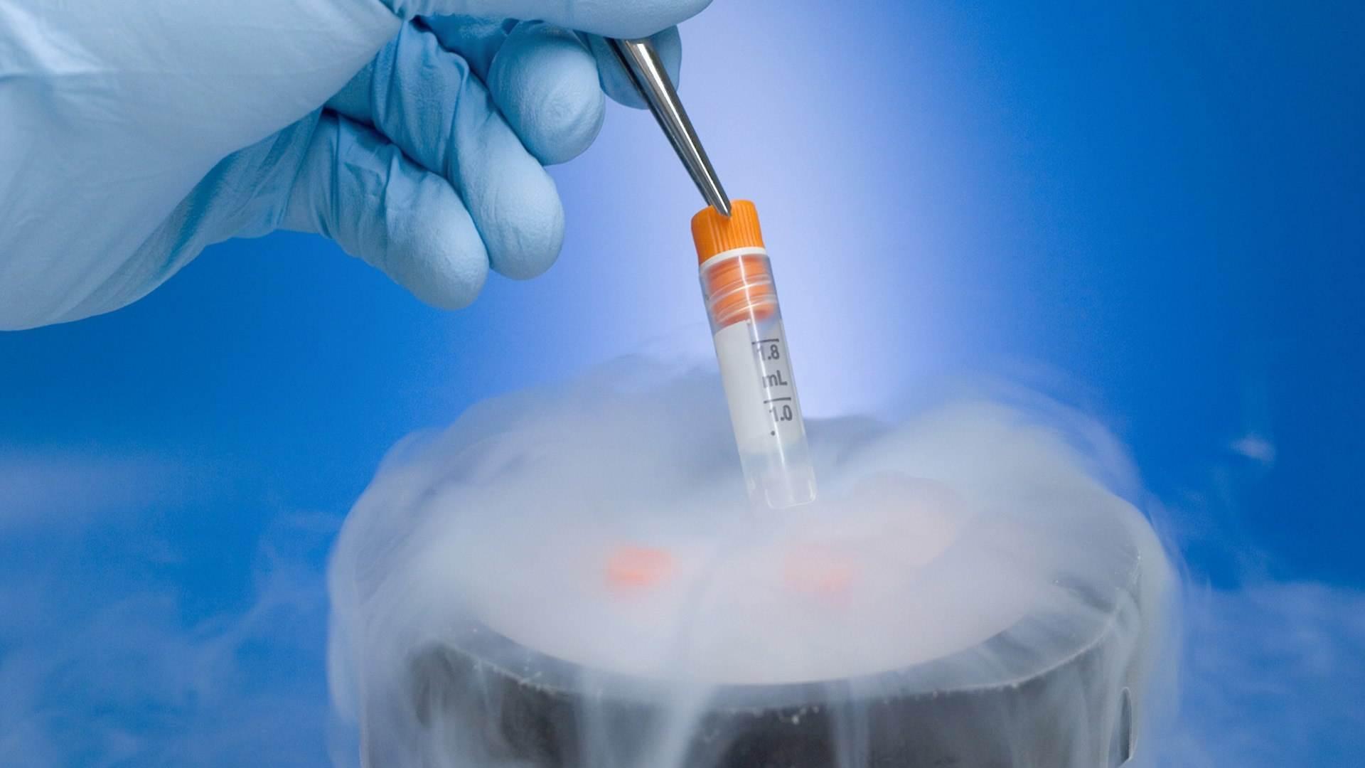 美国试管婴儿选择单胚胎(eSET)移植的常见问题_美中桥