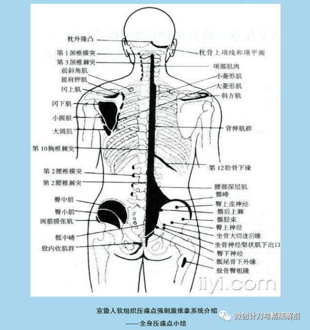 强刺激推拿系统介绍——全身压痛点小结