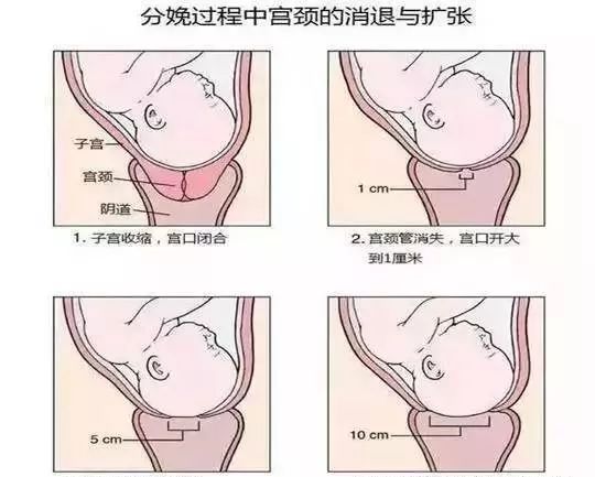 宫口张开的过程相对较迟缓,通常怀孕第9个月后的第2