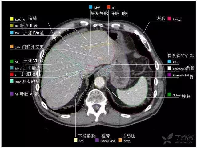 掌握这篇解剖,晋级腹部ct影像诊断高手(精细版)