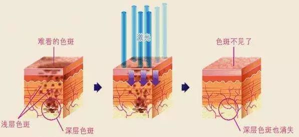 反黑期怎么办