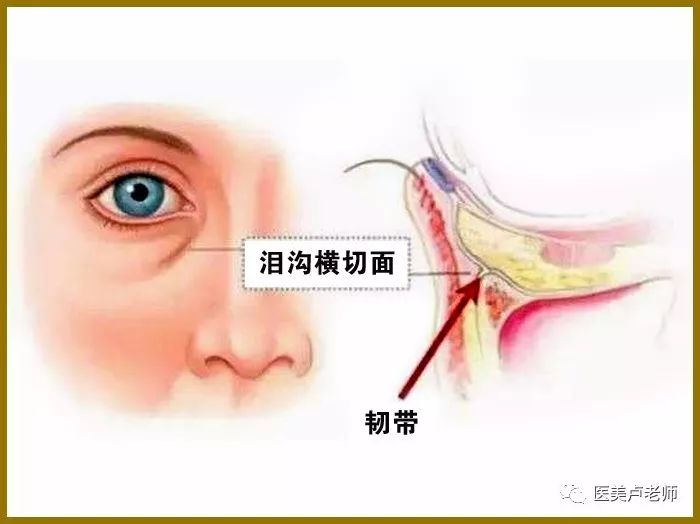 韧带在面部年轻化中的作用