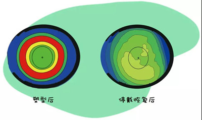 寒假将结束角膜塑形镜复查和停戴换新怎么办