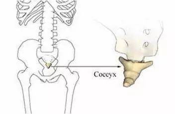 尾骨骨折了该怎么办 压迫