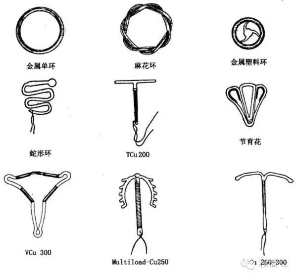 上环是什么原理放在什么地方_上环是什么原理图片(2)