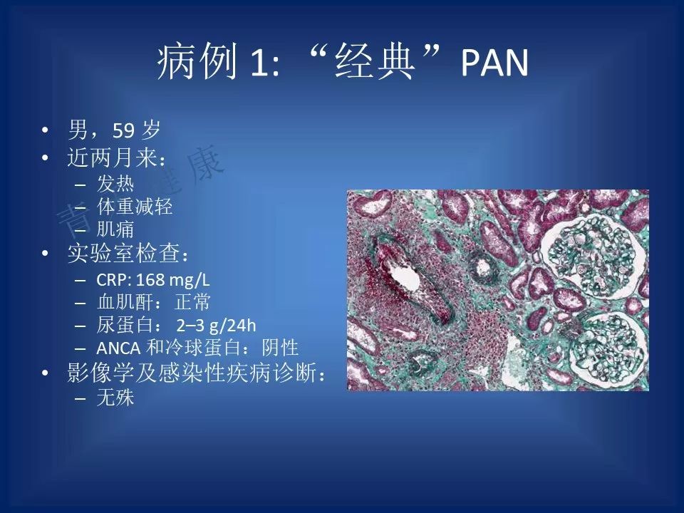 2018acr | 结节性多动脉炎