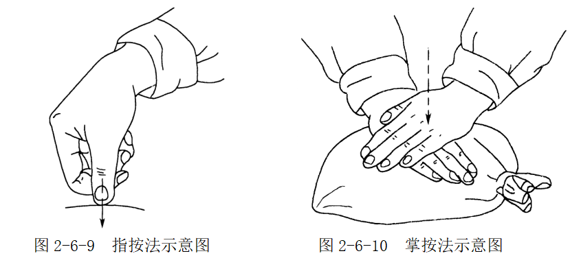 掌按法 用掌根,鱼际或全掌着力按压体表,单手力量不足时,可用双手掌