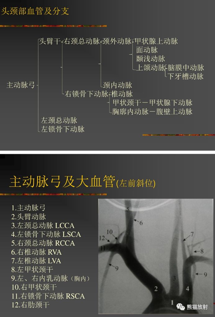 解剖丨头颈部血管_动脉