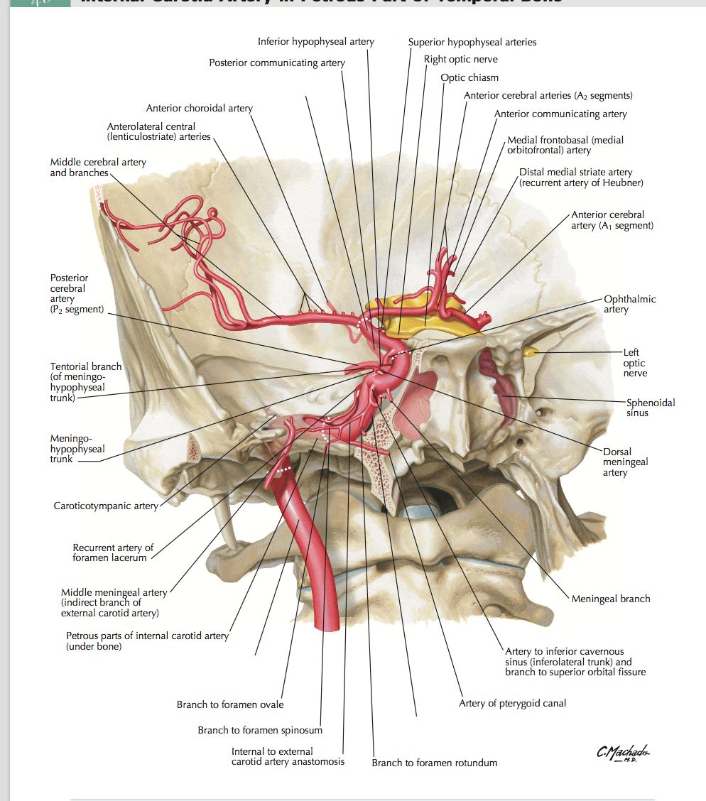 【推荐】颈内动脉走形图谱(2):岩段和破裂孔段