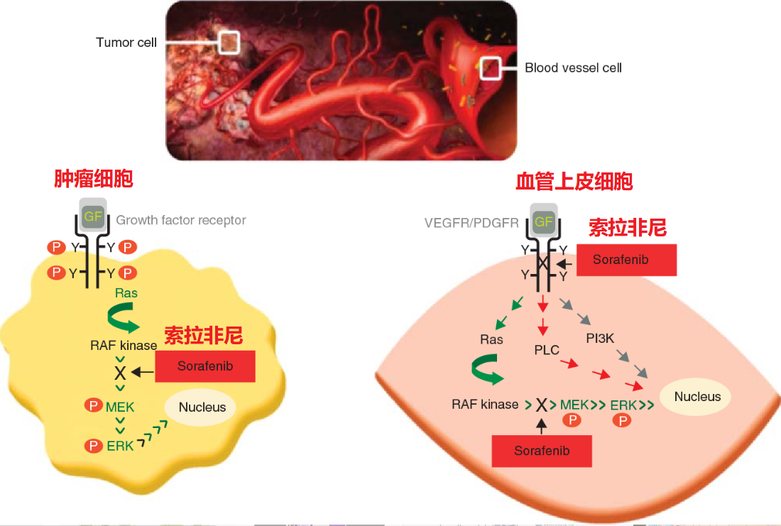 13索拉菲尼抗肿瘤作用机制示意图3,依维莫司依维莫司是一种口服的