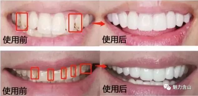 韩国人口臭_牙黄 口臭终结者 韩国传承千年药膳牙膏,10秒去垢亮白,30年老烟牙