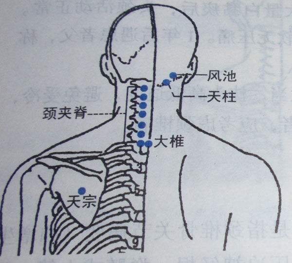 艾灸是颈椎病克星你知道吗了解了这些穴位让你的颈椎健康无忧