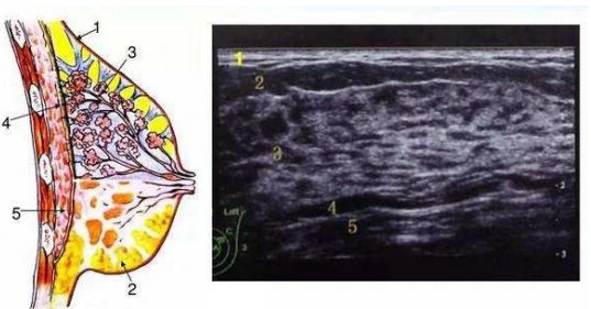 乳腺彩超pk钼靶女性朋友都该了解如何选择