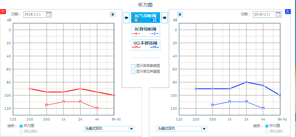 纯音测听如下