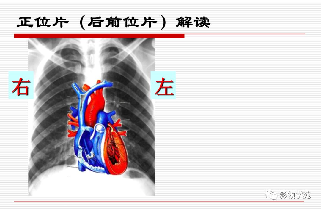 心血管影像学检查解读与合理应用