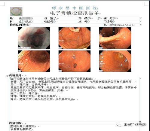 南琼教授为患者做胃镜检查报告单