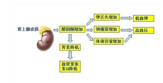 原发性醛固酮增多症(简称原醛症)病因不甚明了,而继发性醛固酮增多症