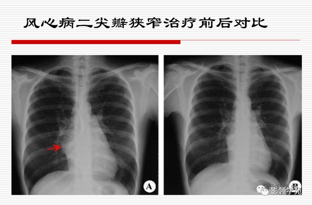 心血管影像学检查解读与合理应用