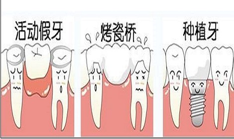 牙齿缺失三种修复的方法