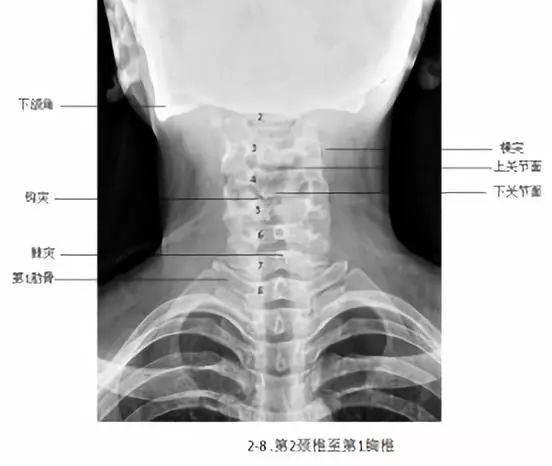 颈椎正位