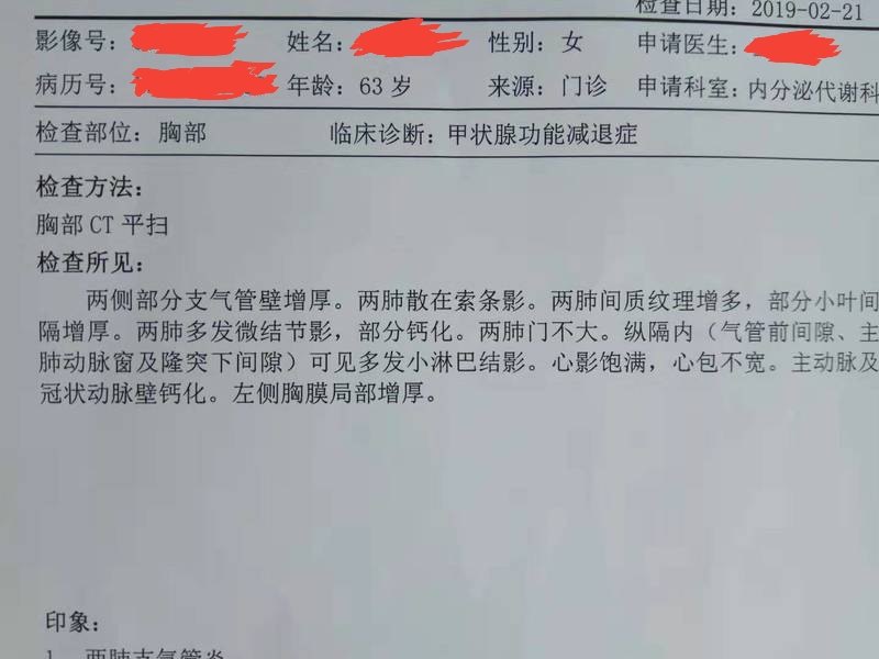 刘懿博士说肺癌(八〇〇)ct报告有肺结节想马上知道良恶怎么. (原创)