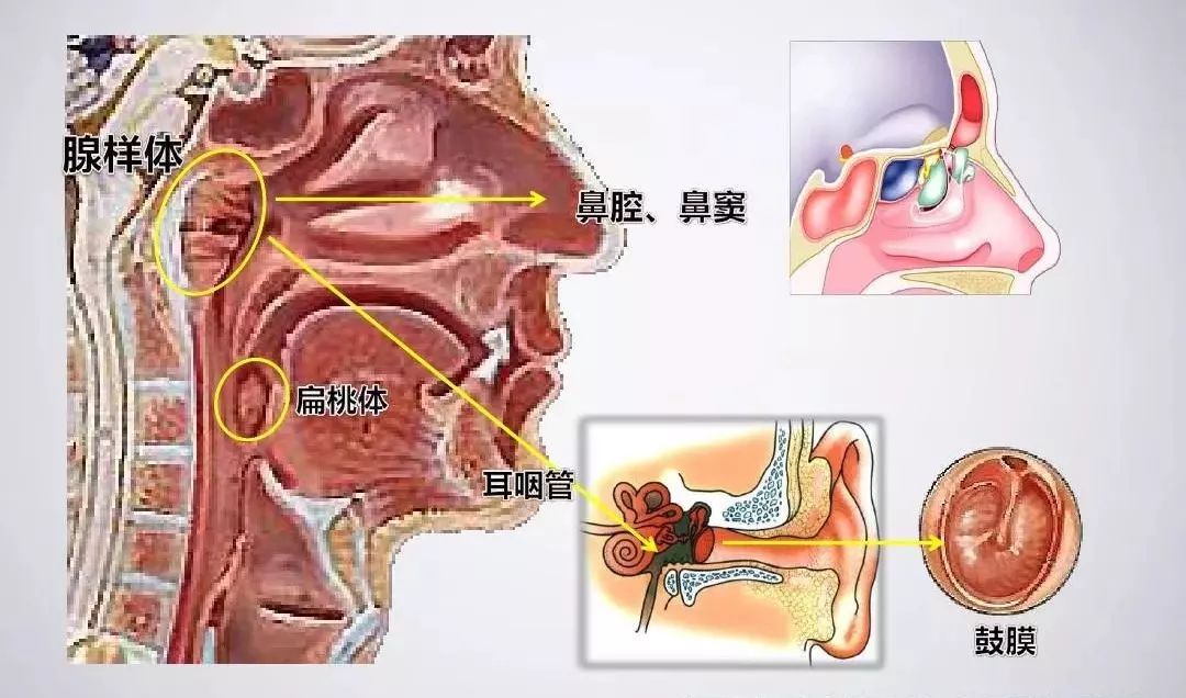 扁桃体,腺样体傻傻分不清楚?看完本文你就明白了!