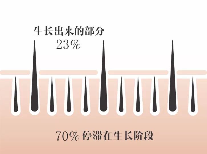 睫毛长怎么办